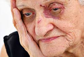 An old woman with an injured face
